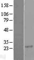 RGS8 Human Over-expression Lysate