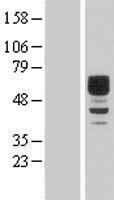 DIXDC1 Human Over-expression Lysate
