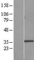 IMP4 Human Over-expression Lysate