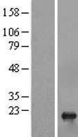 C1orf19 (TSEN15) Human Over-expression Lysate