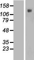 IFT122 Human Over-expression Lysate
