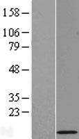 RPL39L Human Over-expression Lysate