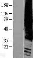 EDG2 (LPAR1) Human Over-expression Lysate
