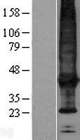 SCAMP4 Human Over-expression Lysate