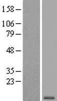 WFDC6 Human Over-expression Lysate