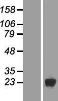 DUSP19 Human Over-expression Lysate