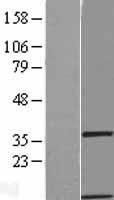 GIMAP1 Human Over-expression Lysate