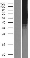 ZNF384 Human Over-expression Lysate