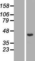 Rad51L1 (RAD51B) Human Over-expression Lysate