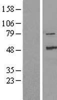 ZAK (MAP3K20) Human Over-expression Lysate