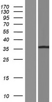 PANK1 Human Over-expression Lysate