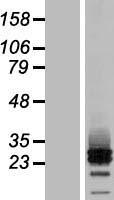 MRAP2 Human Over-expression Lysate