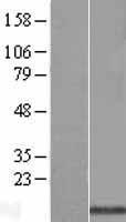 SPTSSA Human Over-expression Lysate