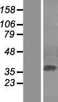 ERK2 (MAPK1) Human Over-expression Lysate