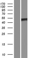 TRIOBP Human Over-expression Lysate