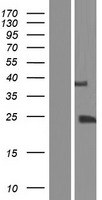 TGIF2LY Human Over-expression Lysate