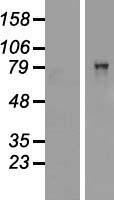 CARS1 Human Over-expression Lysate