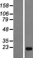 ANKRD22 Human Over-expression Lysate