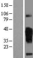 TMIGD2 Human Over-expression Lysate