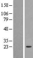 CEP20 Human Over-expression Lysate