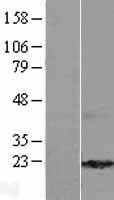 C10orf82 Human Over-expression Lysate