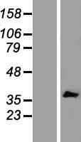 IL20RB Human Over-expression Lysate