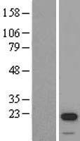 STK32A Human Over-expression Lysate