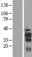 PABIR2 Human Over-expression Lysate
