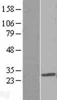 PDCD10 Human Over-expression Lysate
