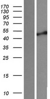 Sphingomyelin Synthase 1 (SGMS1) Human Over-expression Lysate