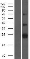 ZNRF2 Human Over-expression Lysate