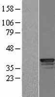 Cathepsin L (CTSL) Human Over-expression Lysate