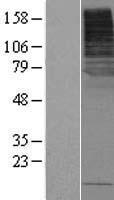 SLC5A8 Human Over-expression Lysate