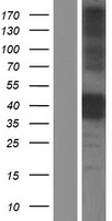 Cathepsin B (CTSB) Human Over-expression Lysate
