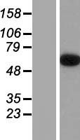 Epsin 2 (EPN2) Human Over-expression Lysate