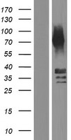 Cathepsin E (CTSE) Human Over-expression Lysate