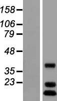 MTRFR Human Over-expression Lysate