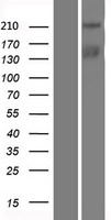 C15orf42 (TICRR) Human Over-expression Lysate