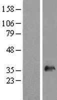 SNX11 Human Over-expression Lysate