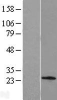 C1orf158 Human Over-expression Lysate