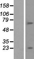 BTBD11 Human Over-expression Lysate