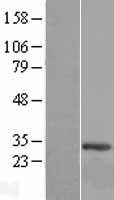 NOPCHAP1 Human Over-expression Lysate