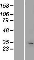 KRT222P (KRT222) Human Over-expression Lysate