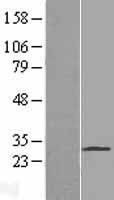 PAQR4 Human Over-expression Lysate
