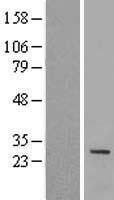 IQCF1 Human Over-expression Lysate