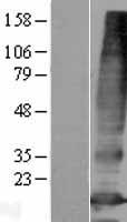 SLC66A3 Human Over-expression Lysate