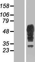 Bestrophin 3 (BEST3) Human Over-expression Lysate