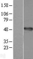 AMDHD1 Human Over-expression Lysate