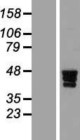 ZNF362 Human Over-expression Lysate
