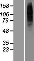 TLCD4 Human Over-expression Lysate